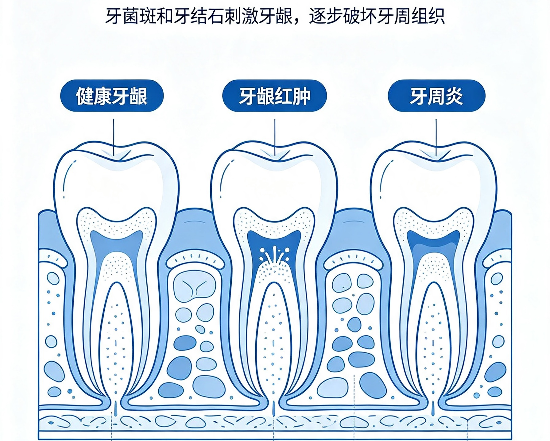 上传图片